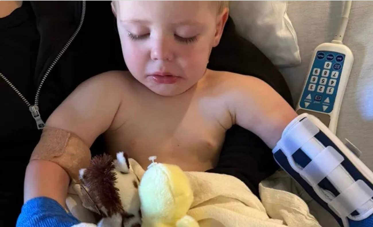 Toddler hospitalized with serious burns after falling into fire pit ...