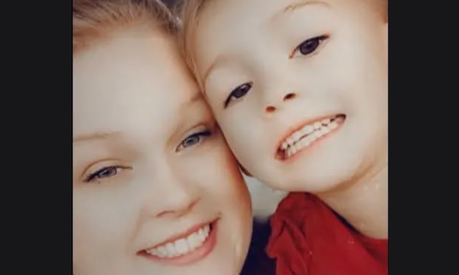 Minnesota 6-year-old hospitalized after being attacked by three dogs ...
