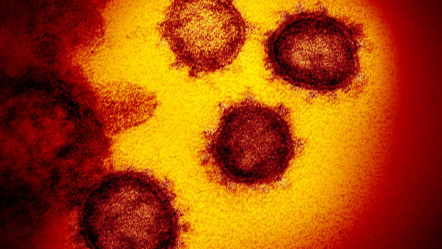 SARS-CoV-2, novel coronavirus