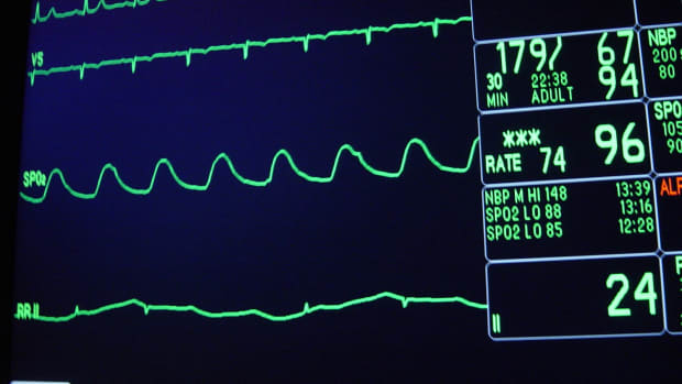 heart monitor, hospital