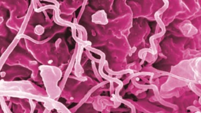 Minnesota reports 'concerning level' of syphilis cases