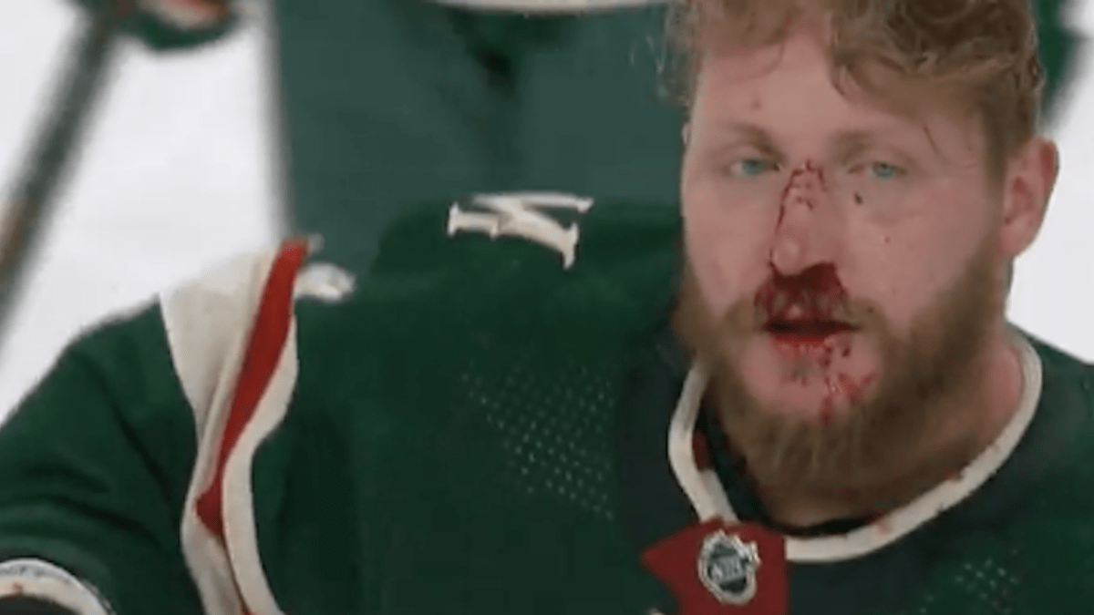 Watch: Nicolas Deslauriers gets in bloody fight vs. Flyers - Bring Me The  News