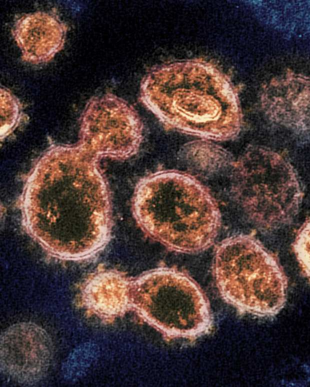coronavirus, SARS-CoV-2