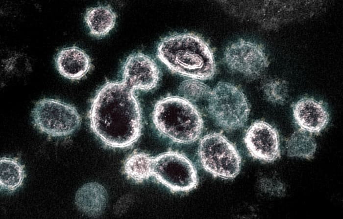 novel coronavirus, covid-19, sars-cov-2