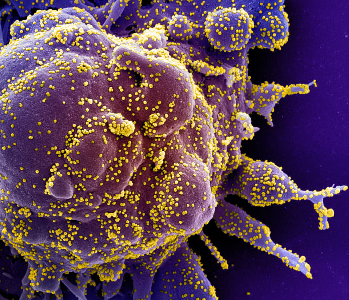 coronavirus