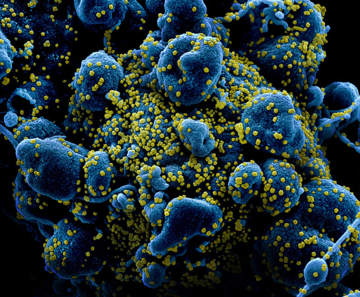 coronavirus, SARS-CoV-2, covid-19
