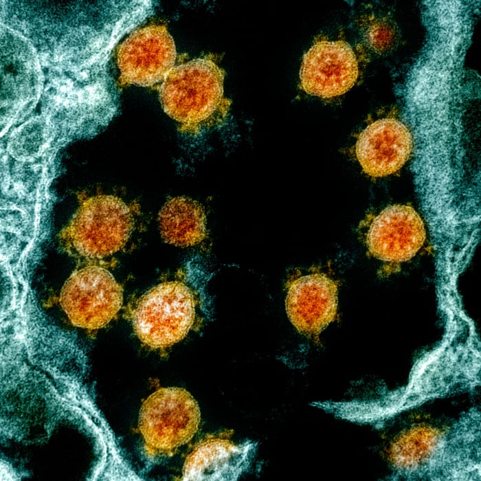 coronavirus