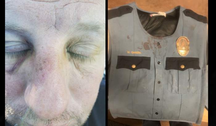 Photos from the St. Paul Police Department show bruising on Officer Michael Ganzel's face and blood on his uniform.