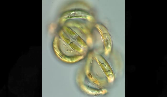 Living cells of Semiorbis eliasiae are joined in spherical colonies.