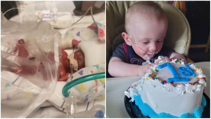 Given 0% chance to live, Baby Richard celebrates 1st birthday, earns ...