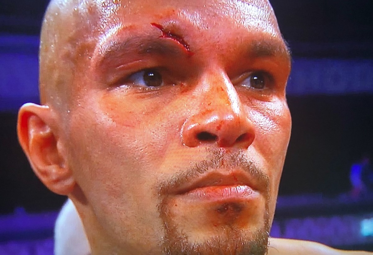 Nationally televised Caleb Truax fight in Minneapolis