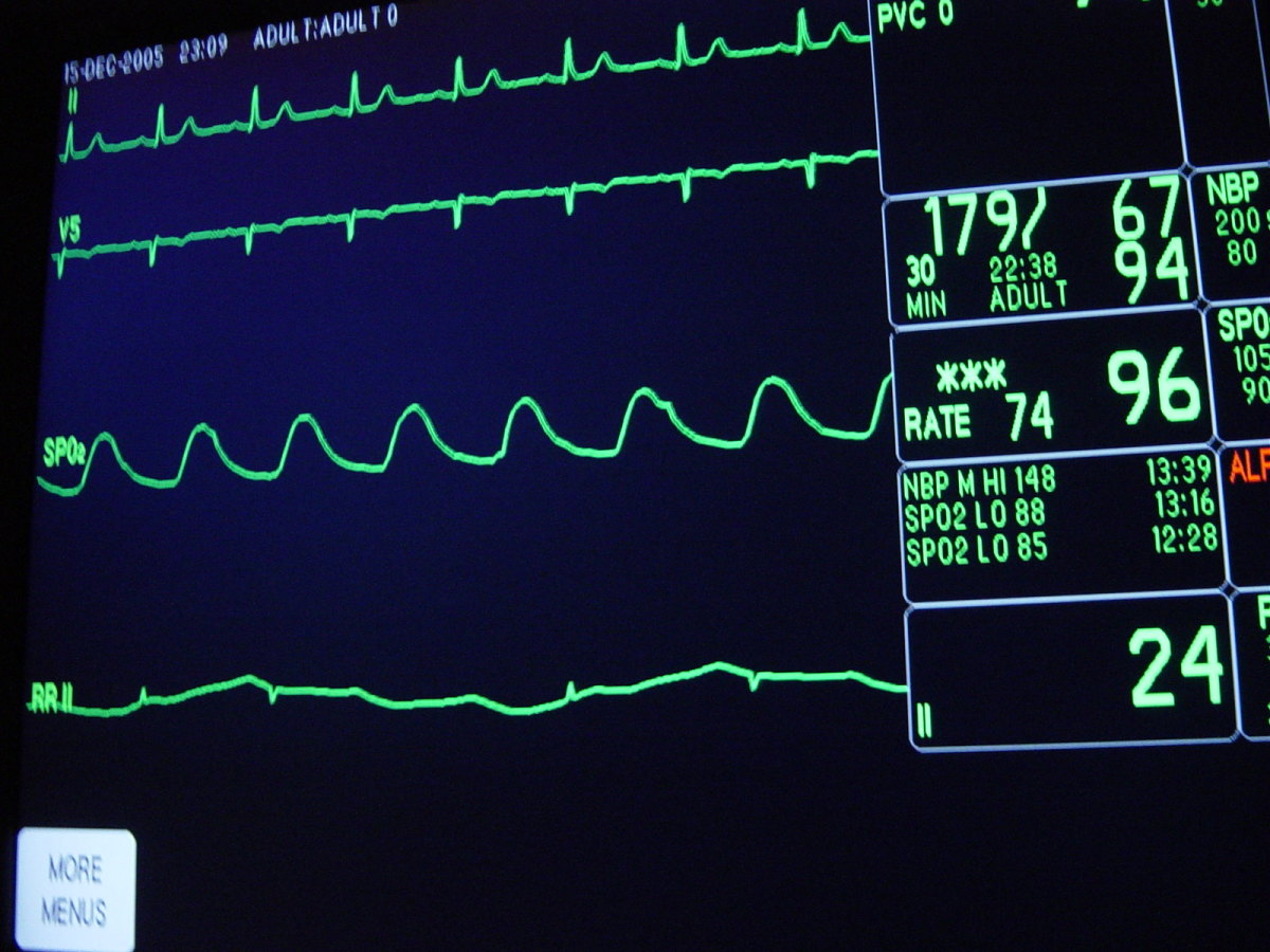 heart monitor, hospital