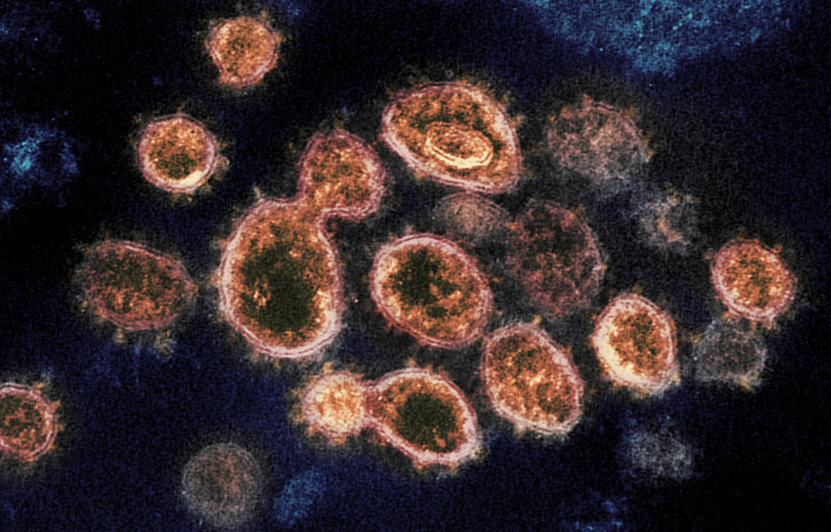 coronavirus, SARS-CoV-2