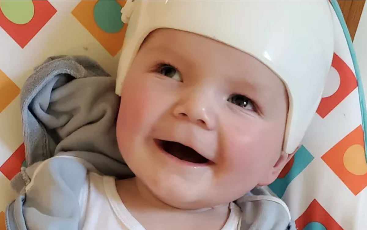 Minnesota family learns their baby has extremely rare, fatal disease Minnesota family learns their baby has extremely rare, fatal disease