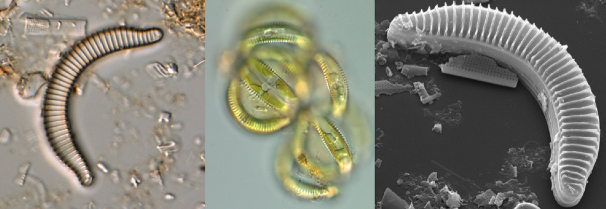 Cells of the new species Semiorbis eliasiae from Lake Superior’s Apostle Islands live in spherical colonies (center) and have spines and ridges on their outer surface when viewed in a light (left) or scanning electron (right) microscope.