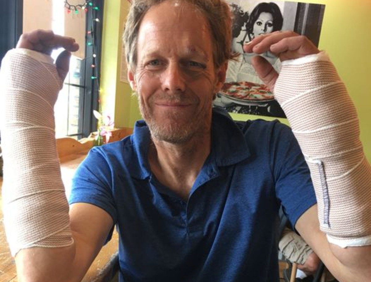 Facebook - Tuey Wilson Comic Stunt Juggler - broken wrists