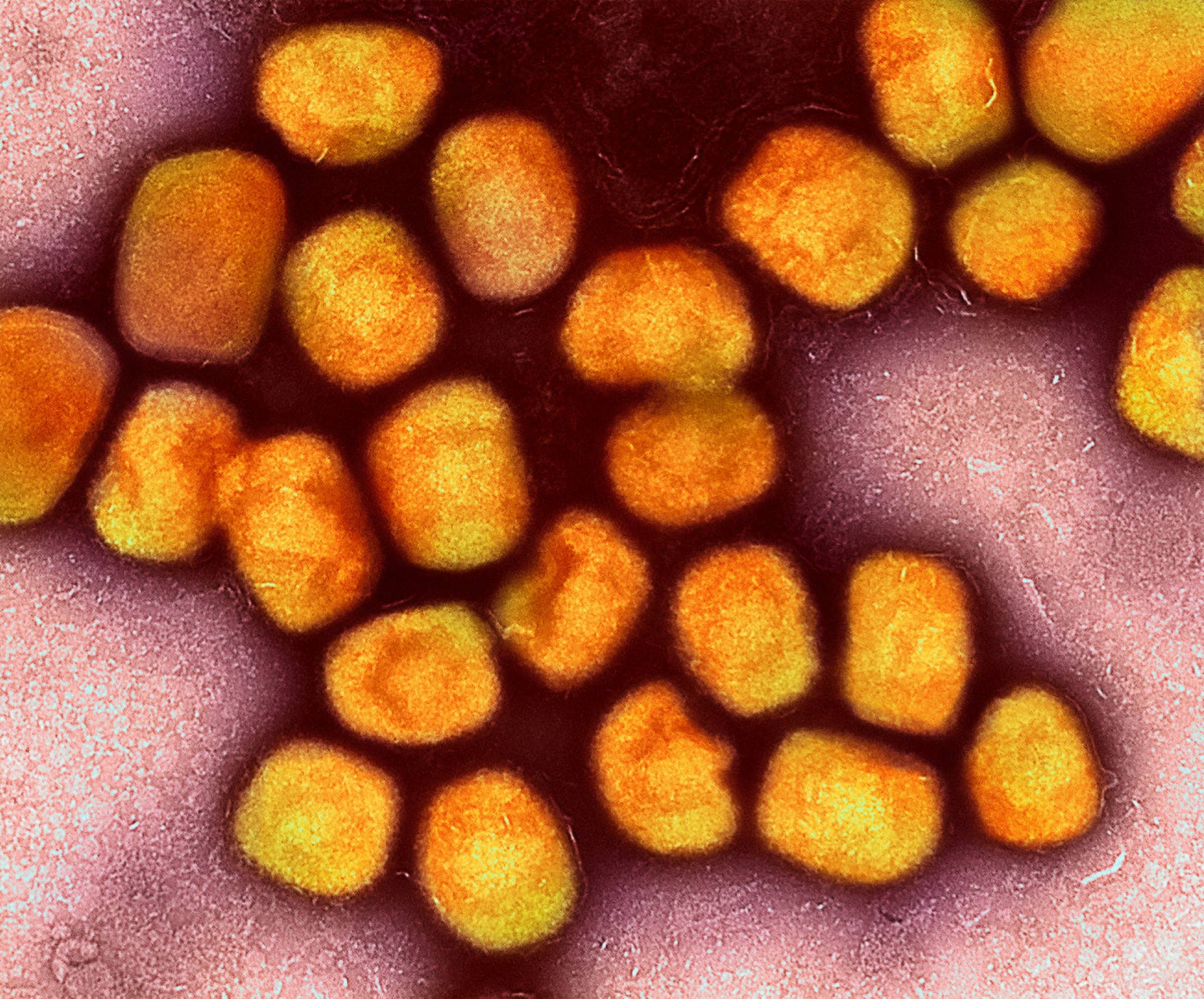 Minnesota health officials warn monkeypox cases could grow rapidly - Vimarsana News